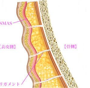 リガメントのない部分だけが凹むことで、皮膚に凸凹を伴うたるみが生じてしまう