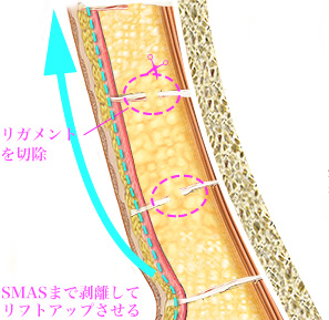 口角やほうれい線の部分まで高いリフトアップ効果が現れます