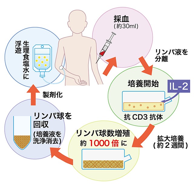 活性リンパ球療法について